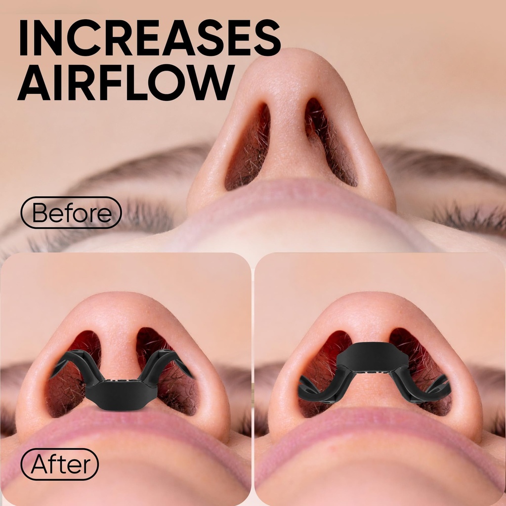 brison-nasal-dilators-for-breathing-and--4.jpg