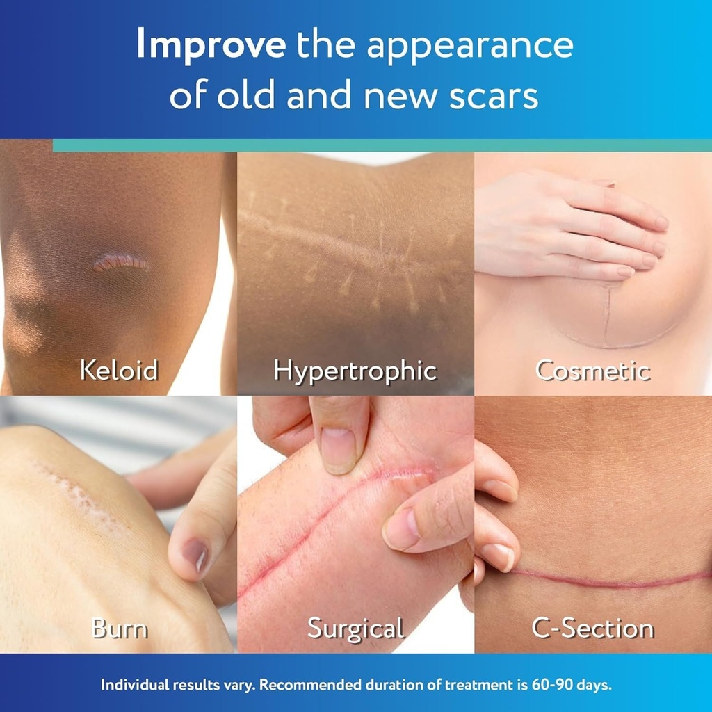 scaraway-advanced-clear-silicone-scar-sh-2.jpg