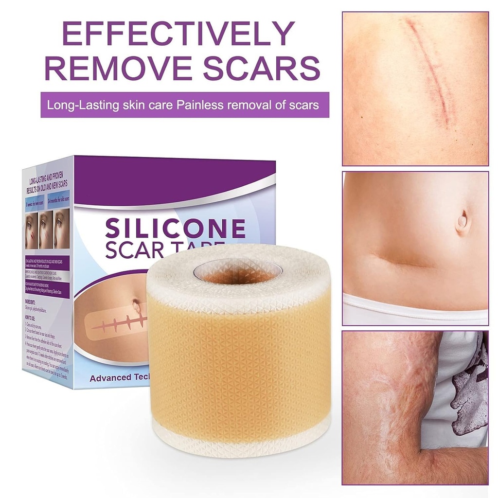 silicone-scar-tape-roll-1-6-x-60-medical-2.jpg