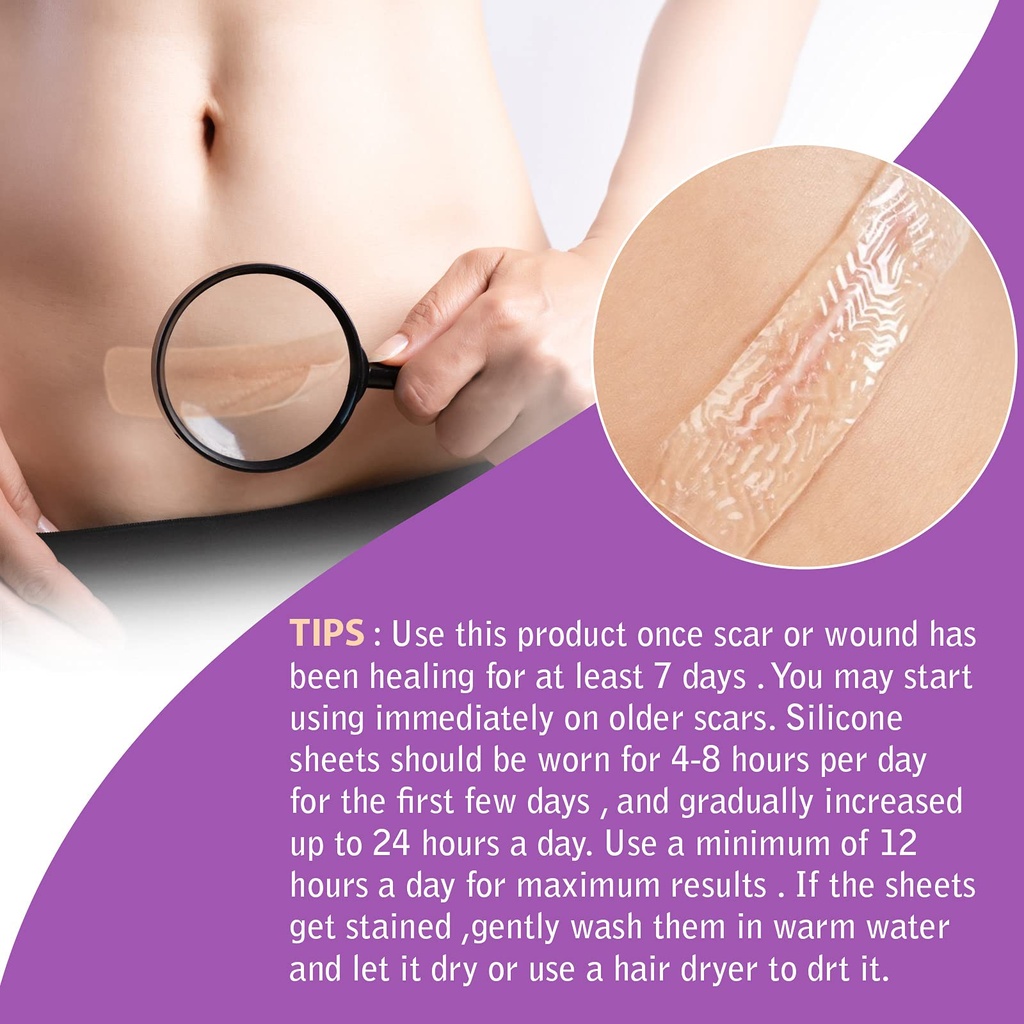 silicone-scar-tape-roll-1-6-x-60-medical-4.jpg