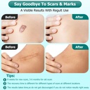 gowgaw-scar-gel-scar-cream-advance-scar--4.jpg
