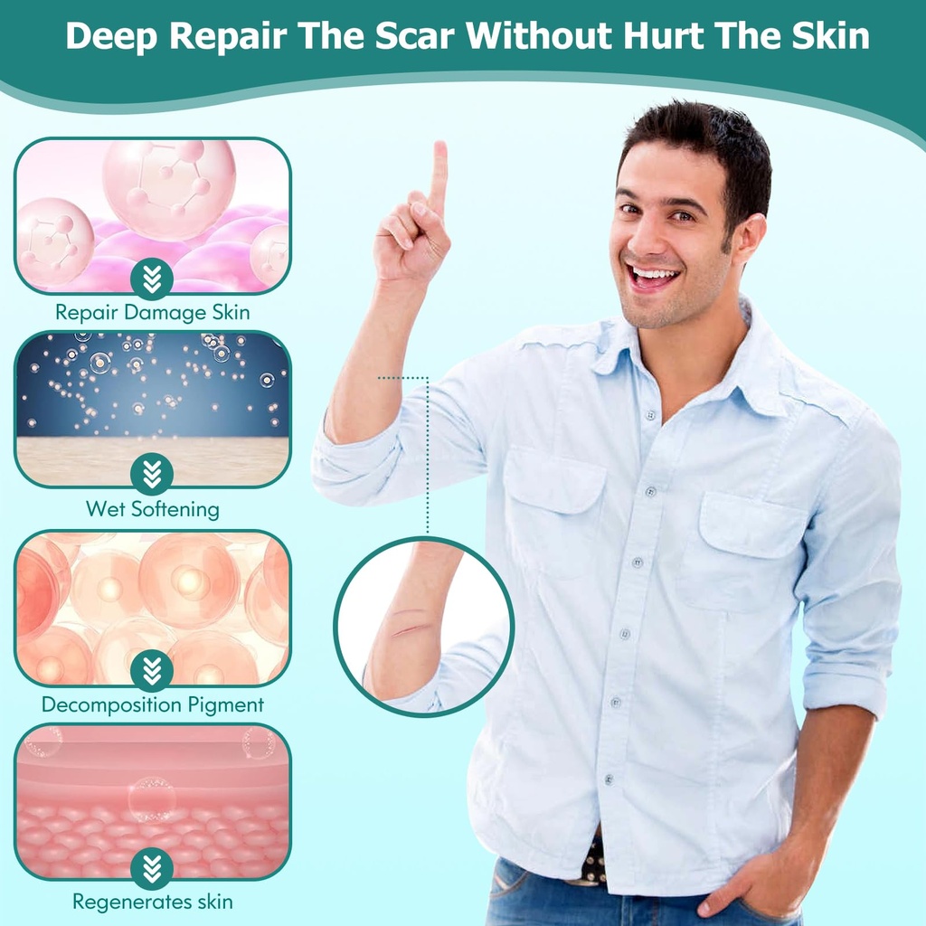 gowgaw-scar-gel-scar-cream-advance-scar--6.jpg