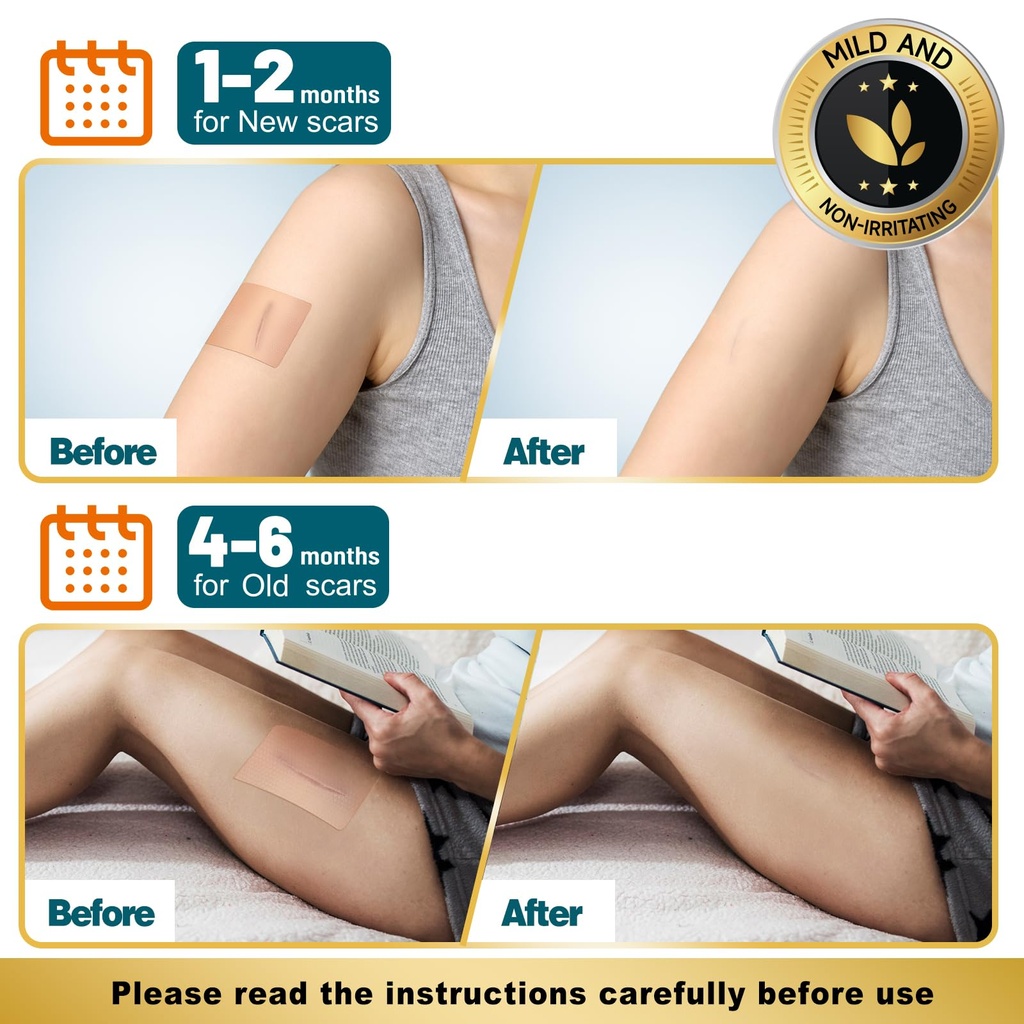 arme-silicone-scar-tape-silicone-scar-sh-5.jpg