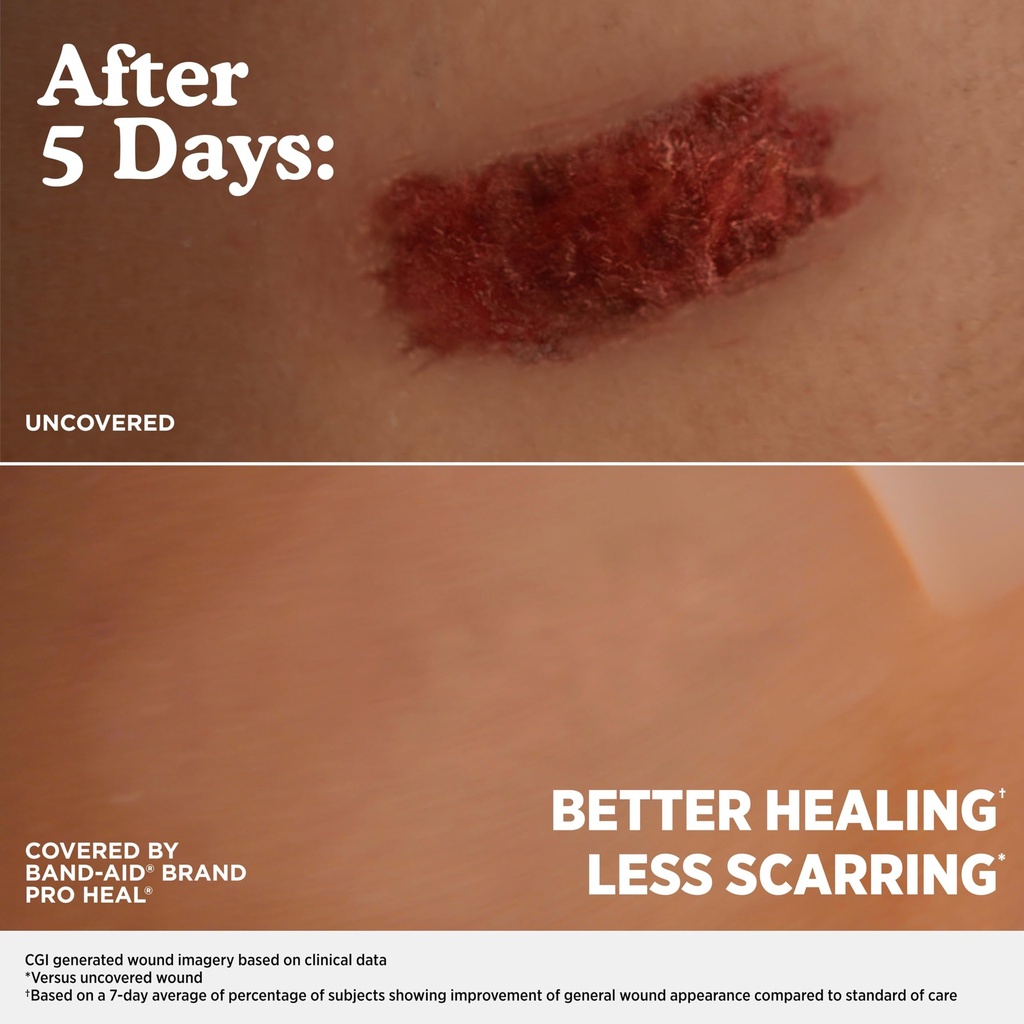band-aid-brand-pro-heal-5-day-protect-hy-6.jpg