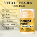 manuka-honey-for-wounds-speed-up-healing-3.jpg