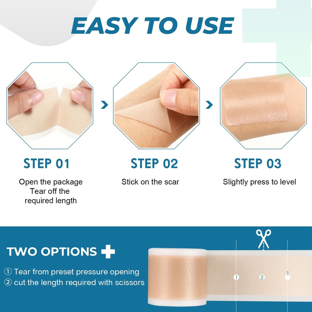 rvlaim-silicone-scar-tape-1-6-x-60-roll--6.jpg