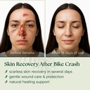 scarless-skin-recovery-natural-first-aid-5.jpg