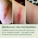 scarless-skin-recovery-natural-first-aid-6.jpg