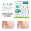 medical-grade-silicone-scar-sheets-silic-2.jpg