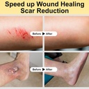 manuka-honey-for-wounds-speed-up-healing-5.jpg