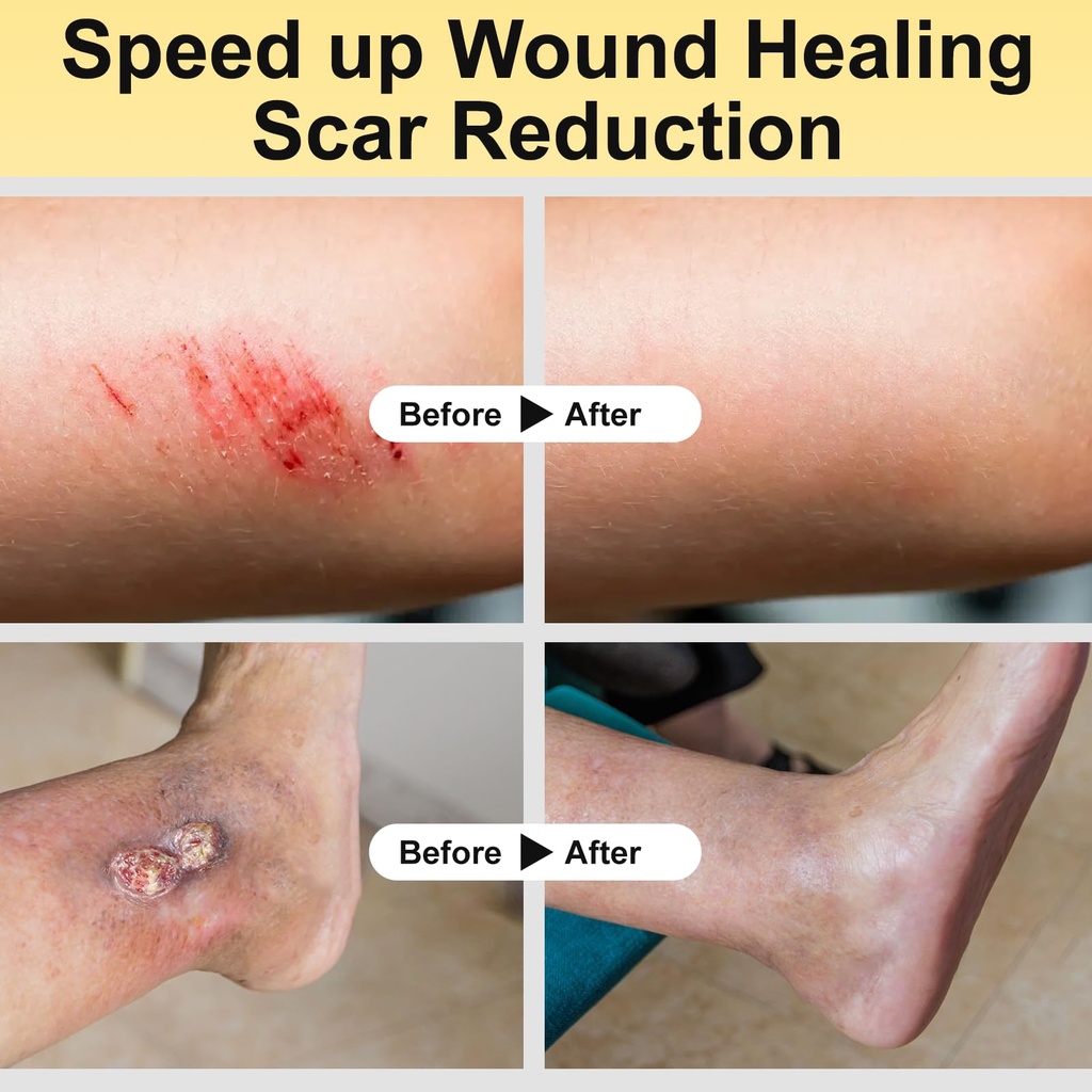 manuka-honey-for-wounds-great-for-cuts-s-5.jpg