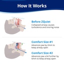 zquiet-anti-snoring-mouthpiece-2-size-st-3.jpg