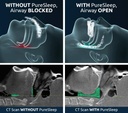 bundle-puresleep-anti-snoring-mouthpiece-4.jpg