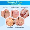 nail-fungus-treatment-pen-for-damaged-na-3.jpg