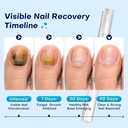 nail-fungus-treatment-pen-for-damaged-na-5.jpg