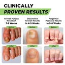 footcure-antifungal-nail-treatment-pen-e-4.jpg
