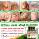 toenail-fungus-treatment-extra-strength--4.jpg