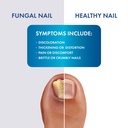 fungal-shield-max-strength-brush-on-anti-3.jpg