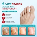 nail-fungus-pen-toenail-fungus-treatment-5.jpg