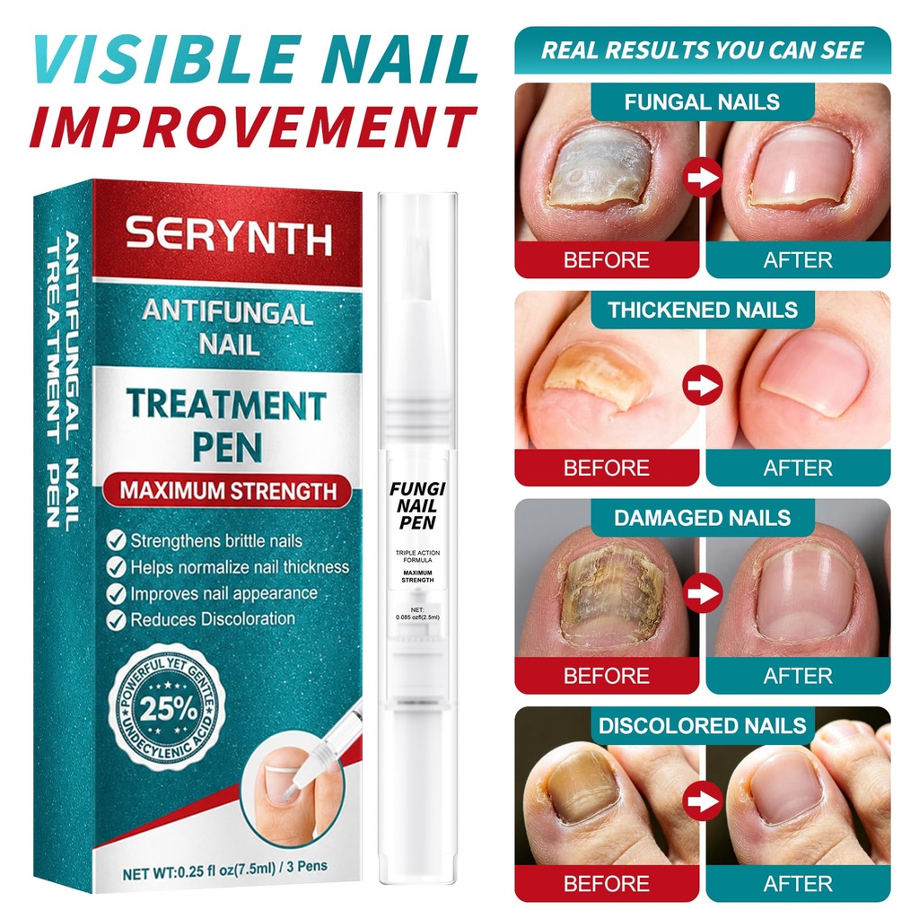 nail-fungus-pen-toenail-fungus-treatment-4.jpg