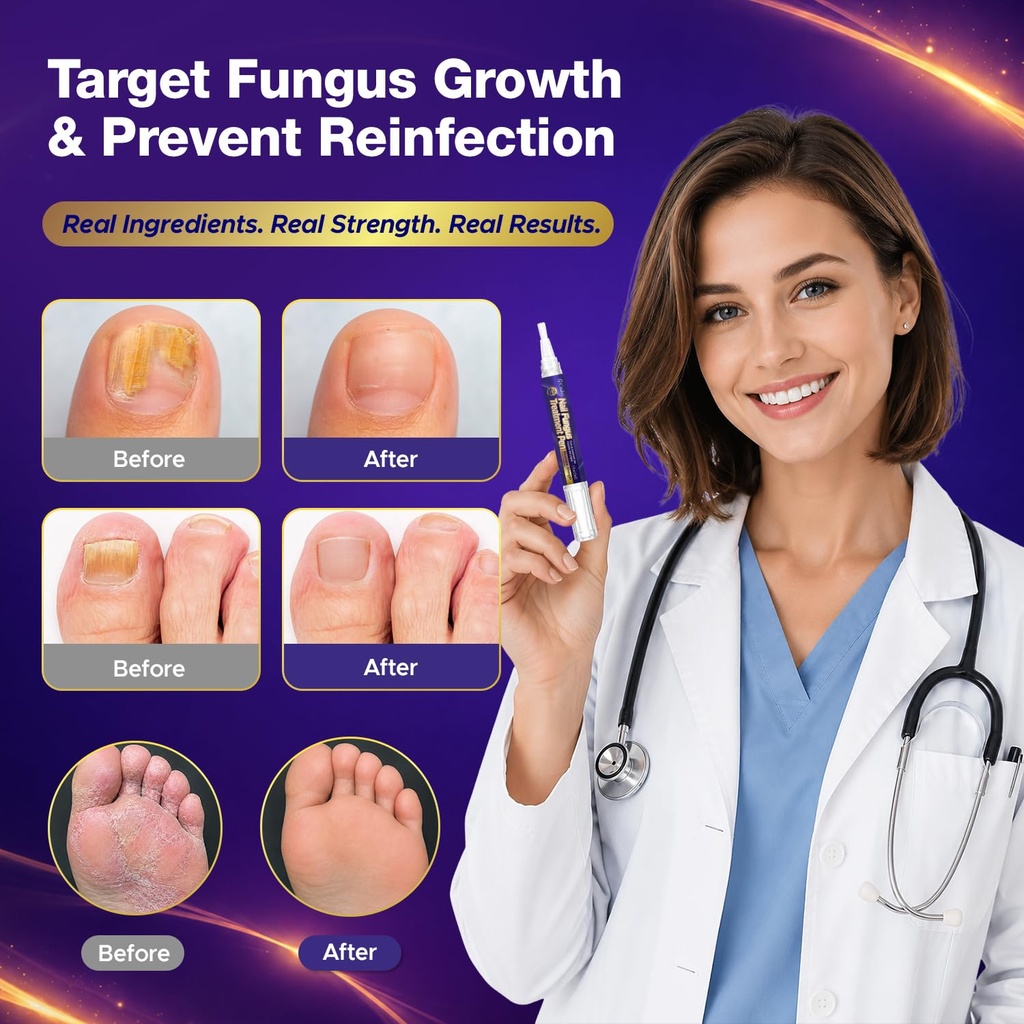 toenail-fungus-treatment-pen-extra-stren-2.jpg