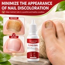 2pcs-fungi-nail-toenailtreatment-gentle--4.jpg