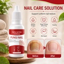 2pcs-fungi-nail-toenailtreatment-gentle--2.jpg