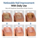 vrenmol-toenail-fungus-treatment-extra-s-3.jpg