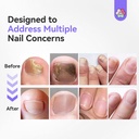 saviland-toenail-fungus-treatment-pen-25-2.jpg