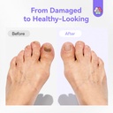 saviland-toenail-fungus-treatment-pen-25-6.jpg