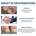 toenail-fungus-treatment-extra-strength--5.jpg