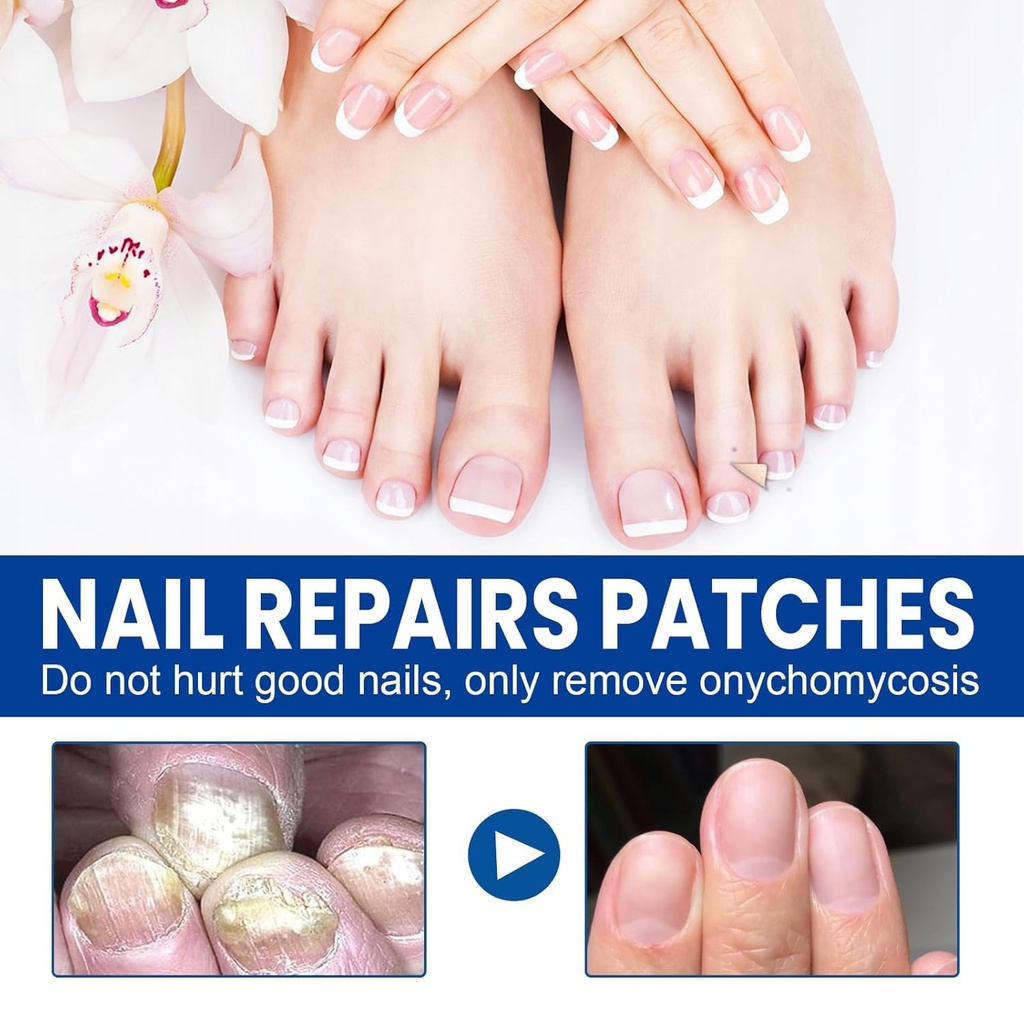 toenail-fungus-treatment-extra-strength--3.jpg