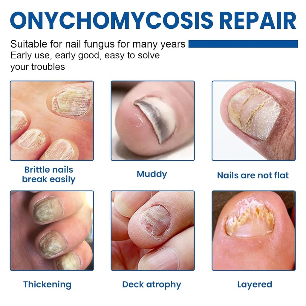 toenail-fungus-treatment-extra-strength--2.jpg