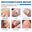 toenail-fungus-treatment-extra-strength--2.jpg