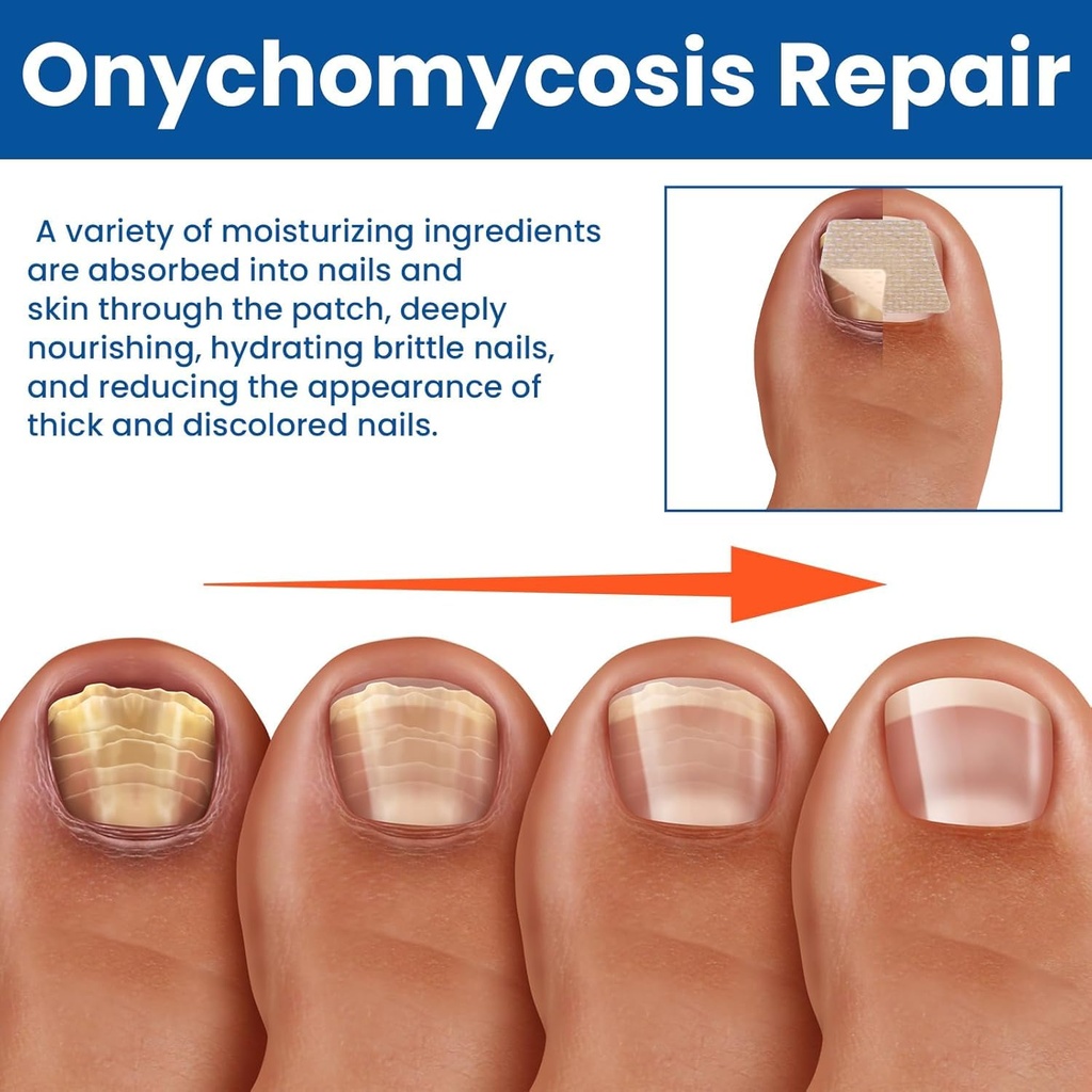 toenail-fungus-treatment-extra-strength--6.jpg