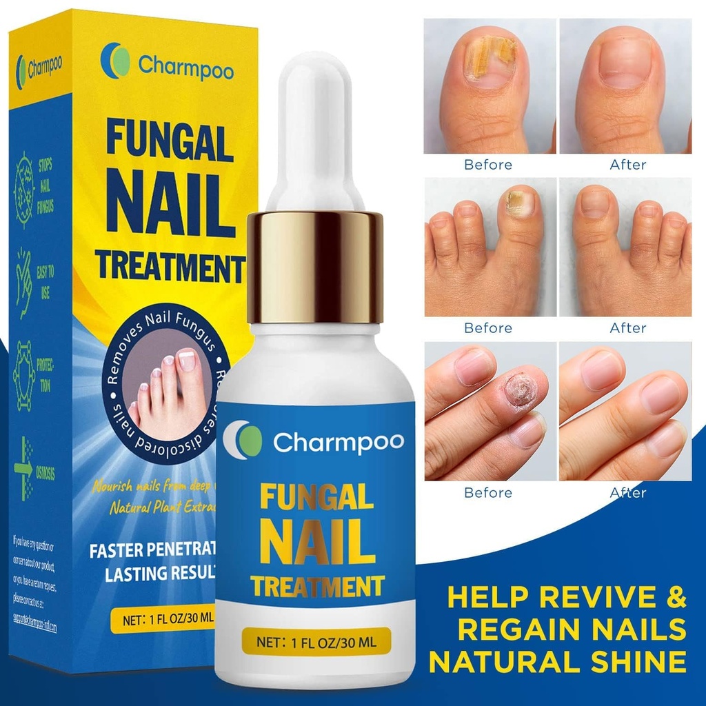 toenail-fungus-treatment-extra-strength--2.jpg