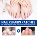 fungal-nail-patches-60-pcs-upgraded-toe--4.jpg