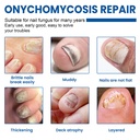 fungal-nail-patches-60-pcs-upgraded-toe--2.jpg