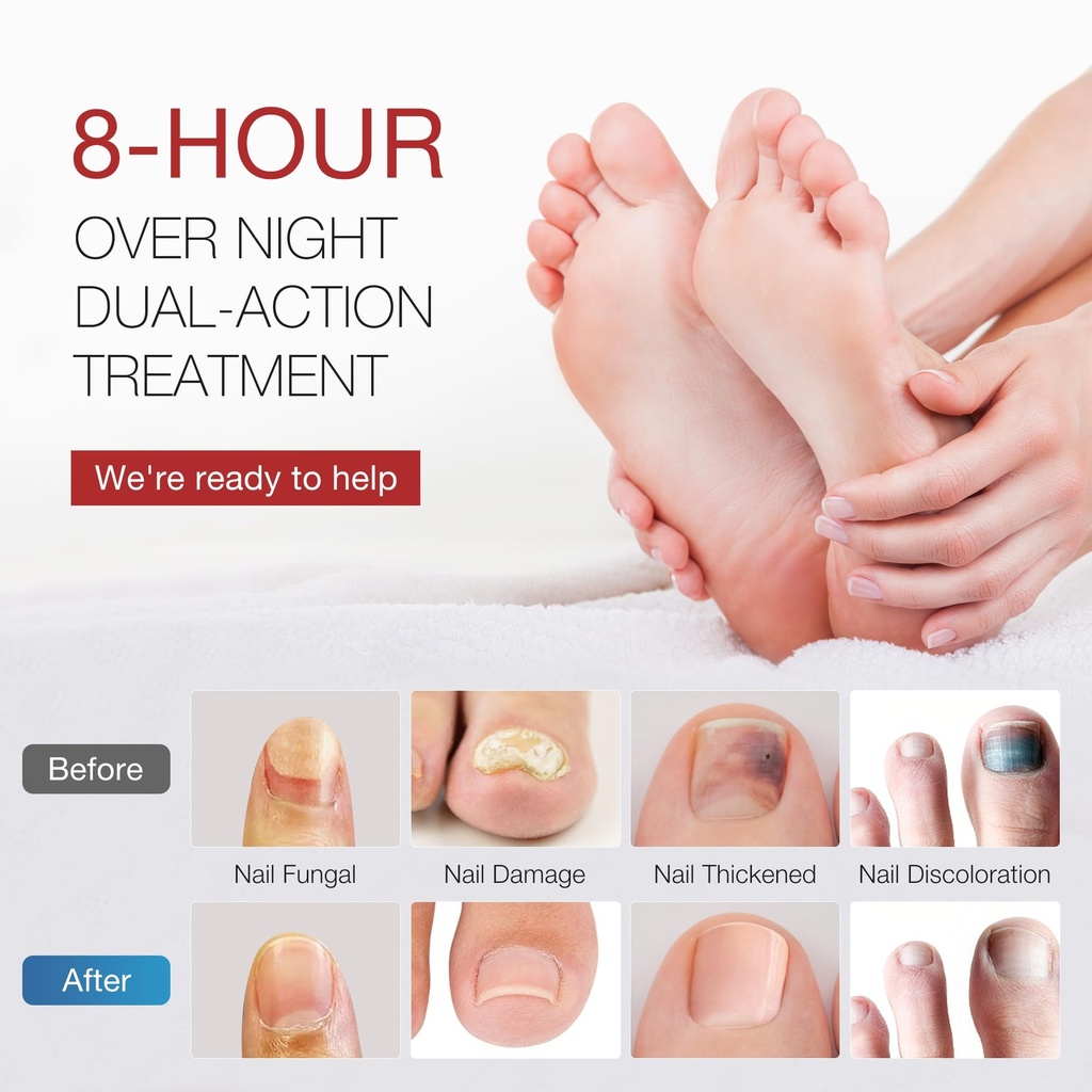 toenail-fungus-treatment-extra-strength--5.jpg