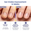 toenail-daily-care-pen-with-25-undecylen-2.jpg