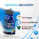 toenail-fungus-treatment-extra-strength--3.jpg