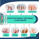 toenail-treatment-nail-repair-pen-nail-s-4.jpg