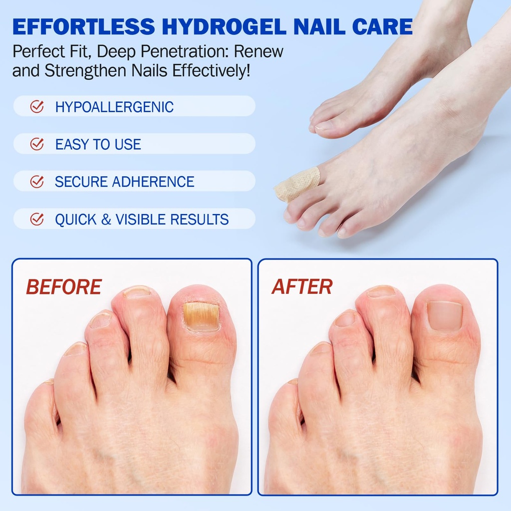 nail-patches-for-toenails-42pcs-hydrogel-4.jpg