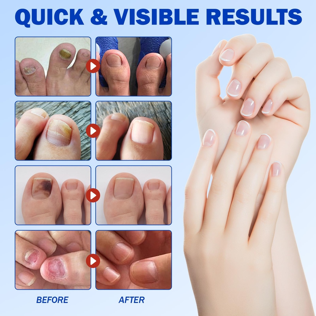 nail-patches-for-toenails-42pcs-hydrogel-3.jpg