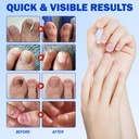 nail-patches-for-toenails-42pcs-hydrogel-3.jpg
