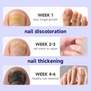fingernails-toenail-fungus-treatment-ext-2.jpg