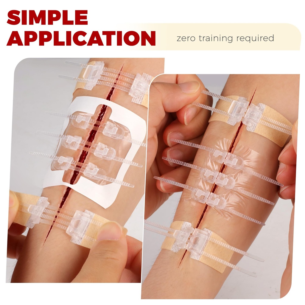 wound-closure-kit-8-zip-complete-kit-xer-6.jpg