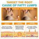 lipoma-treatment-for-dogs-control-and-pr-4.jpg