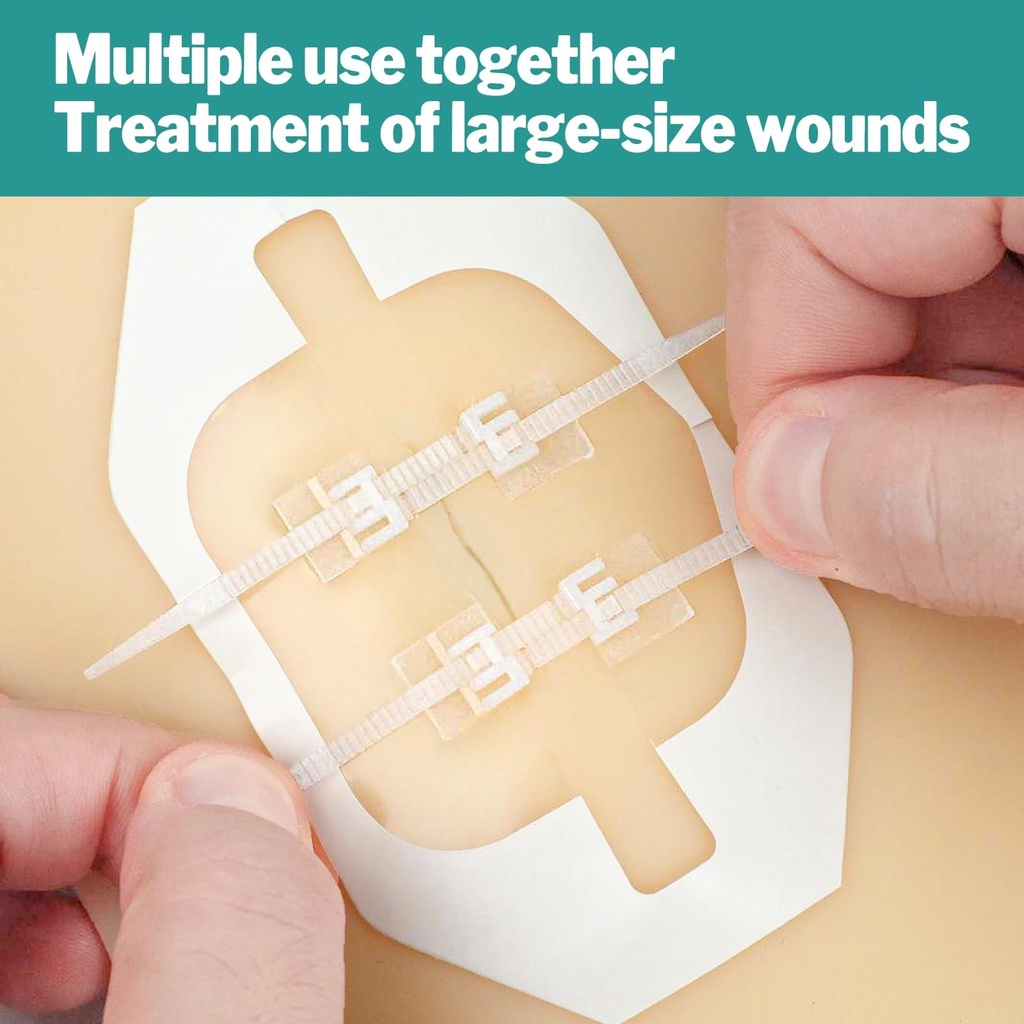 azen-10-pack-emergency-wound-closure-str-4.jpg