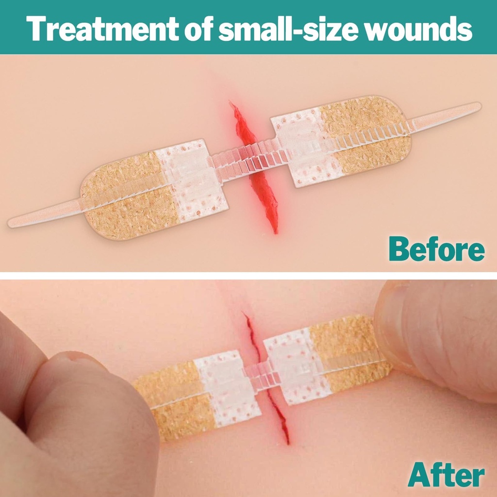 azen-12-pack-emergency-wound-closure-str-4.jpg